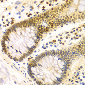 DKC1 / Dyskerin Antibody - Immunohistochemistry of paraffin-embedded Human colon tissue.