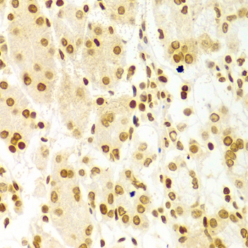DKC1 / Dyskerin Antibody - Immunohistochemistry of paraffin-embedded Human gastric tissue.