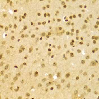 DKC1 / Dyskerin Antibody - Immunohistochemistry of paraffin-embedded Mouse brain tissue.