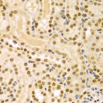 DKC1 / Dyskerin Antibody - Immunohistochemistry of paraffin-embedded Mouse kidney tissue.