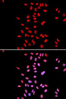 DKC1 / Dyskerin Antibody - Immunofluorescence analysis of U2OS cells.