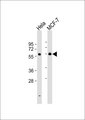 DKC1 / Dyskerin Antibody - All lanes: Anti-Dyskerin Antibody at 1:500-1:1000 dilution. Lane 1: HeLa whole cell lysate. Lane 2: MCF-7 whole cell lysate Lysates/proteins at 20 ug per lane. Secondary Goat Anti-Rabbit IgG, (H+L), Peroxidase conjugated at 1:10000 dilution. Predicted band size: 58 kDa. Blocking/Dilution buffer: 5% NFDM/TBST.