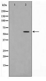 DKC1 / Dyskerin Antibody - Western blot of HeLa cell lysate using Dyskerin Antibody