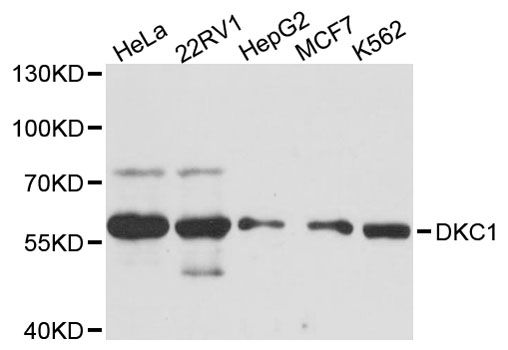 DKC1 / Dyskerin Antibody - Western blot analysis of extracts of various cell lines, using DKC1 antibody at 1:3000 dilution. The secondary antibody used was an HRP Goat Anti-Rabbit IgG (H+L) at 1:10000 dilution. Lysates were loaded 25ug per lane and 3% nonfat dry milk in TBST was used for blocking. An ECL Kit was used for detection and the exposure time was 60s.