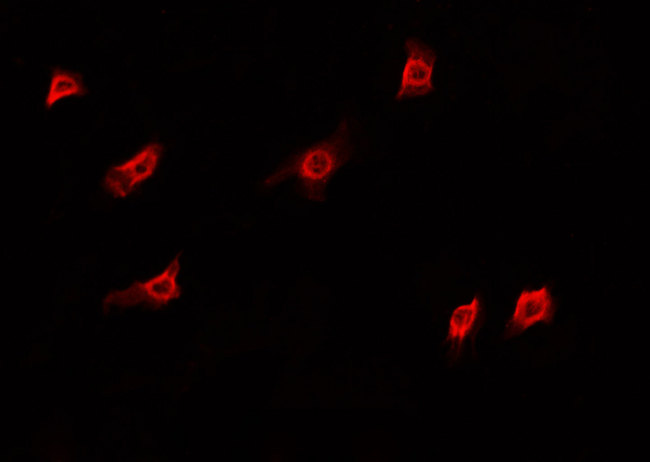 DKC1 / Dyskerin Antibody - Staining HeLa cells by IF/ICC. The samples were fixed with PFA and permeabilized in 0.1% Triton X-100, then blocked in 10% serum for 45 min at 25°C. The primary antibody was diluted at 1:200 and incubated with the sample for 1 hour at 37°C. An Alexa Fluor 594 conjugated goat anti-rabbit IgG (H+L) Ab, diluted at 1/600, was used as the secondary antibody.