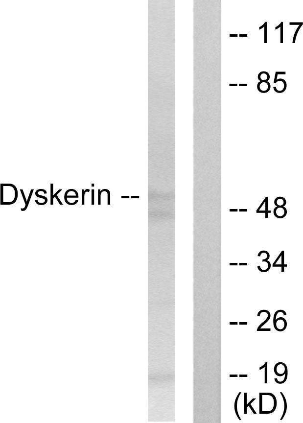 DKC1 / Dyskerin Antibody - Western blot analysis of extracts from HeLa cells, using Dyskerin antibody.