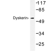 DKC1 / Dyskerin Antibody - Western blot of Dyskerin (K203) pAb in extracts from HeLa cells.