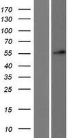 DKC1 / Dyskerin Protein - Western validation with an anti-DDK antibody * L: Control HEK293 lysate R: Over-expression lysate
