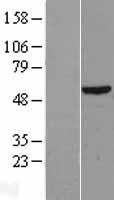 DKC1 / Dyskerin Protein - Western validation with an anti-DDK antibody * L: Control HEK293 lysate R: Over-expression lysate