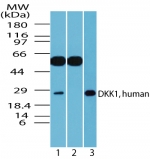 DKK1 Antibody - Western blot of human DKK1 in A549 cell lysate in the 1) absence and 2) presence of immunizing peptide, and 3) RAW using antibody at 1 ug/ml.