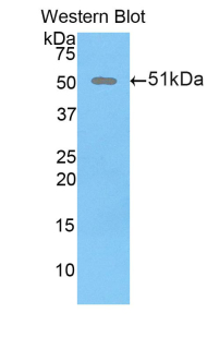 DKK1 Antibody - Western blot of recombinant DKK1.  This image was taken for the unconjugated form of this product. Other forms have not been tested.