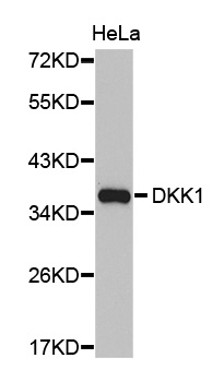 DKK1 Antibody - Western blot analysis of extracts of HeLa cells.