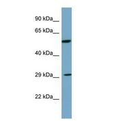 DKK1 Antibody - Western blot of Human PANC1. DKK1 antibody dilution 1.0 ug/ml.  This image was taken for the unconjugated form of this product. Other forms have not been tested.