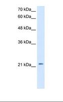 DKK1 Antibody - HepG2 cell lysate. Antibody concentration: 2.5 ug/ml. Gel concentration: 12%.  This image was taken for the unconjugated form of this product. Other forms have not been tested.