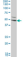 DKK1 Antibody - DKK1 monoclonal antibody (M08), clone 2B12 Western blot of DKK1 expression in HeLa.