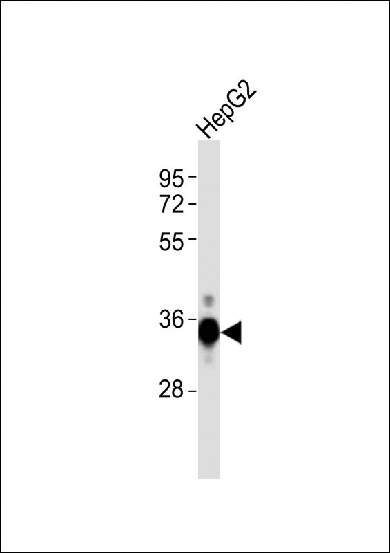 DKK1 Antibody - Anti-DKK1 Antibody at 1:1000 dilution + HepG2 whole cell lysates Lysates/proteins at 20 ug per lane. Secondary Goat Anti-Rabbit IgG, (H+L), Peroxidase conjugated at 1/10000 dilution Predicted band size : 29 kDa Blocking/Dilution buffer: 5% NFDM/TBST.