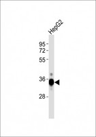 DKK1 Antibody - Anti-DKK1 Antibody at 1:1000 dilution + HepG2 whole cell lysates Lysates/proteins at 20 ug per lane. Secondary Goat Anti-Rabbit IgG, (H+L), Peroxidase conjugated at 1/10000 dilution Predicted band size : 29 kDa Blocking/Dilution buffer: 5% NFDM/TBST.