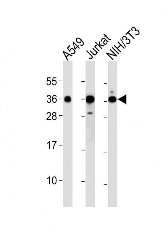 DKK1 Antibody - All lanes : Anti-DKK1 Antibody at 1:2000 dilution Lane 1: A549 whole cell lysates Lane 2: Jurkat whole cell lysates Lane 3: NIH/3T3 whole cell lysates Lysates/proteins at 20 ug per lane. Secondary Goat Anti-Rabbit IgG, (H+L), Peroxidase conjugated at 1/10000 dilution Predicted band size : 29 kDa Blocking/Dilution buffer: 5% NFDM/TBST.