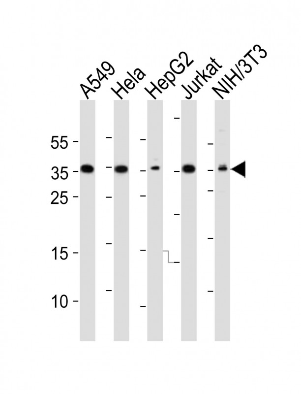 DKK1 Antibody - Western blot of lysates from A549, HeLa, HepG2, Jurkat, mouse NIH/3T3 cell line (from left to right), using DKK1 Antibody. A goat anti-rabbit IgG H&L (HRP) at 1:10000 dilution was used as the secondary antibody. Lysates at 20 ug per lane.
