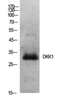 DKK1 Antibody - Western Blot analysis of extracts from Hela cells using DKK1 Antibody.