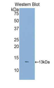 DKK2 Antibody - Western blot of recombinant DKK2.  This image was taken for the unconjugated form of this product. Other forms have not been tested.