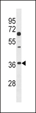 DKK2 Antibody - DKK2 Antibody (C239) western blot of 293 cell line lysates (35 ug/lane). The DKK2 antibody detected the DKK2 protein (arrow).