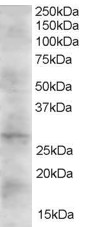 DKK2 Antibody - Antibody (2 ug/ml) staining of Human Heart lysate (35 ug protein in RIPA buffer). Primary incubation was 1 hour. Detected by chemiluminescence.