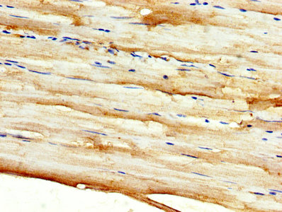 DKK2 Antibody - IHC image of DKK2 Antibody diluted at 1:500 and staining in paraffin-embedded human skeletal muscle tissue performed on a Leica BondTM system. After dewaxing and hydration, antigen retrieval was mediated by high pressure in a citrate buffer (pH 6.0). Section was blocked with 10% normal goat serum 30min at RT. Then primary antibody (1% BSA) was incubated at 4°C overnight. The primary is detected by a biotinylated secondary antibody and visualized using an HRP conjugated SP system.