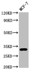 DKK2 Antibody - Western Blot Positive WB detected in: MCF-7 whole cell lysate All lanes: DKK2 antibody at 3.9µg/ml Secondary Goat polyclonal to rabbit IgG at 1/50000 dilution Predicted band size: 29 kDa Observed band size: 32 kDa