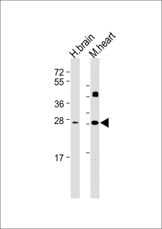 DKK2 Antibody - All lanes: Anti-DKK2 Antibody at 1:2000 dilution Lane 1: Human brain lysate Lane 2: Mouse heart lysate Lysates/proteins at 20 µg per lane. Secondary Goat Anti-mouse IgG, (H+L), Peroxidase conjugated at 1/10000 dilution. Predicted band size: 28 kDa Blocking/Dilution buffer: 5% NFDM/TBST.