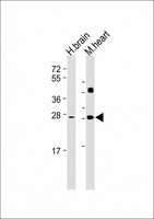 DKK2 Antibody - All lanes: Anti-DKK2 Antibody at 1:2000 dilution Lane 1: Human brain lysate Lane 2: Mouse heart lysate Lysates/proteins at 20 µg per lane. Secondary Goat Anti-mouse IgG, (H+L), Peroxidase conjugated at 1/10000 dilution. Predicted band size: 28 kDa Blocking/Dilution buffer: 5% NFDM/TBST.