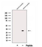DKK2 Antibody - Western blot analysis of extracts of mouse muscle tissue using DKK2 antibody. The lane on the left was treated with blocking peptide.