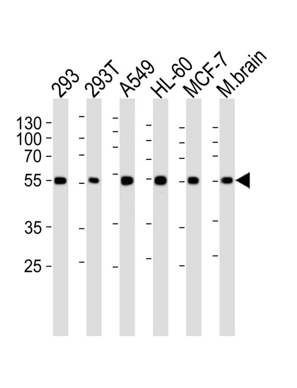 DKK3 Antibody - Western blot of lysates from 293, 293T, A549, HL-60, MCF-7 cell line and mouse brain tissue lysate (from left to right), using DKK3 Antibody (A30). Antibody was diluted at 1:1000 at each lane. A goat anti-rabbit IgG H&L (HRP) at 1:5000 dilution was used as the secondary antibody. Lysates at 35ug per lane.