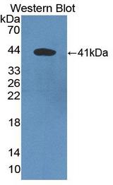 DKK3 Antibody - Western blot of DKK3 antibody.