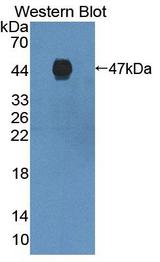 DKK3 Antibody - Western blot of DKK3 antibody.