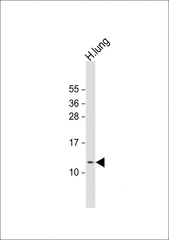 DKK3 Antibody - Anti-RIG Antibody (C-Term) at 1:1000 dilution + human lung lysate Lysates/proteins at 20 ug per lane. Secondary Goat Anti-Rabbit IgG, (H+L), Peroxidase conjugated at 1:10000 dilution. Predicted band size: 12 kDa. Blocking/Dilution buffer: 5% NFDM/TBST.