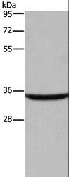 DKK3 Antibody - Western blot analysis of Human fetal brain tissue, using DKK3 Polyclonal Antibody at dilution of 1:200.