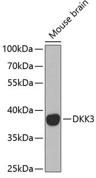 DKK3 Antibody - Western blot analysis of extracts of mouse brain using DKK3 Polyclonal Antibody at dilution of 1:1000.