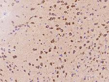 DKK3 Antibody - Immunochemical staining of mouse DKK3 in mouse brain with rabbit polyclonal antibody at 1:1000 dilution, formalin-fixed paraffin embedded sections.