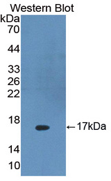 DKK4 Antibody - Western blot of DKK4 antibody.
