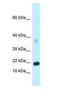 DKK4 Antibody - DKK4 antibody Western Blot of Mouse Pancreas.  This image was taken for the unconjugated form of this product. Other forms have not been tested.