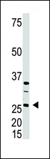 DKK4 Antibody - The anti-DKK4 C-term antibody is used in Western blot to detect DKK4 in A375 cell lysate.