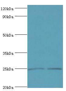 DKK4 Antibody - Western blot. All lanes: Dickkopf-related protein 4 antibody at 8 ug/ml. Lane 1: Jurkat whole cell lysate. Lane 2: K562 whole cell lysate. Secondary antibody: Goat polyclonal to rabbit at 1:10000 dilution. Predicted band size: 25 kDa. Observed band size: 25 kDa Immunohistochemistry.
