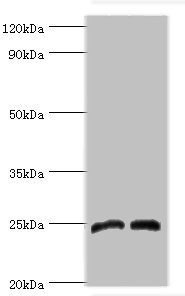 DKK4 Antibody - Western blot All lanes: Dickkopf-related protein 4 antibody at 8µg/ml Lane 1: Jurkat whole cell lysate Lane 2: K562 whole cell lysate Secondary Goat polyclonal to rabbit IgG at 1/10000 dilution Predicted band size: 25 kDa Observed band size: 25 kDa