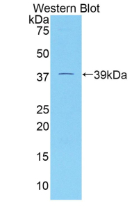 DKK4 Antibody - Western blot of recombinant DKK4.  This image was taken for the unconjugated form of this product. Other forms have not been tested.