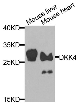 DKK4 Antibody - Western blot analysis of extracts of various cells.