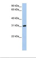 DKKL1 / Soggy-1 Antibody - HepG2 cell lysate. Antibody concentration: 1.0 ug/ml. Gel concentration: 12%.  This image was taken for the unconjugated form of this product. Other forms have not been tested.
