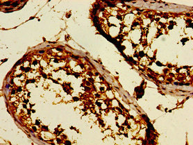 DKKL1 / Soggy-1 Antibody - Immunohistochemistry of paraffin-embedded human testis tissue using DKKL1 Antibody at dilution of 1:100