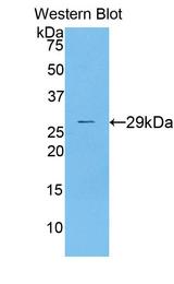 DLAT / PDC-E2 Antibody - Western Blot; Sample: Recombinant protein.