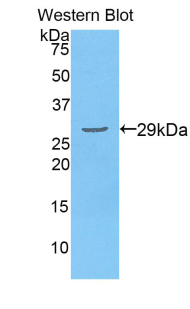 DLAT / PDC-E2 Antibody - Western blot of recombinant DLAT / PDC-E2.  This image was taken for the unconjugated form of this product. Other forms have not been tested.